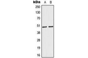 Western blot analysis of Caspase 9 expression in HeLa (A), Jurkat (B) whole cell lysates. (Caspase 9 anticorps  (Center))
