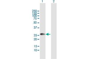 Western Blot analysis of ORC6L expression in transfected 293T cell line by ORC6L MaxPab polyclonal antibody. (ORC6 anticorps  (AA 1-252))