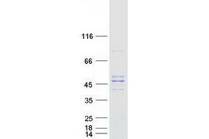 Validation with Western Blot