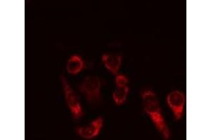 ABIN6269334 staining MCF-7 cells by IF/ICC.