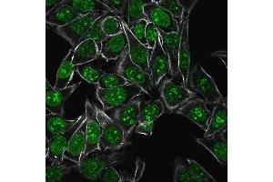 Confocal Immunofluorescence of HeLa cells Ki67 Mouse Monoclonal Antibody (MKI67/2461) labeled with CF488 (Green); WGA (Red) is used to label the membrane. (Ki-67 anticorps  (AA 2293-2478))