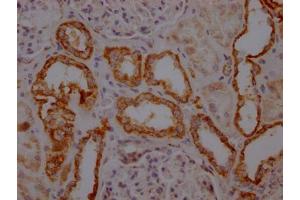 IHC image of ABIN7127849 diluted at 1:100 and staining in paraffin-embedded human kidney tissue performed on a Leica BondTM system.
