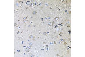 Immunohistochemistry of paraffin-embedded rat brain using MEMO1 antibody (ABIN5995855) at dilution of 1/100 (40x lens). (MEMO1 anticorps)