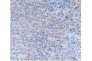 Detection of INHbA in Rat Adrenal Gland Tissue using Monoclonal Antibody to Inhibin Beta A (INHbA) (INHBA anticorps  (AA 314-424))