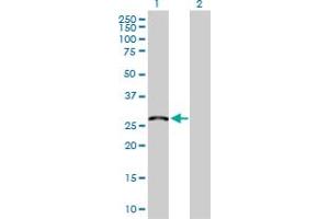 Western Blot analysis of MED6 expression in transfected 293T cell line by MED6 MaxPab polyclonal antibody.