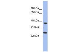 Image no. 1 for anti-Mitochondrial Translational Release Factor 1-Like (MTRF1L) (AA 35-84) antibody (ABIN6744041) (MTRF1L anticorps  (AA 35-84))