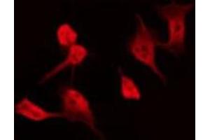 ABIN6275425 staining Hela by IF/ICC.