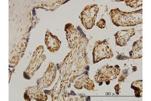 Immunoperoxidase of monoclonal antibody to RPS6KB1 on formalin-fixed paraffin-embedded human placenta.
