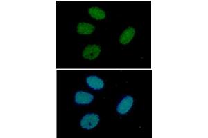 ICC/IF analysis of RuVBL in HeLa cells line, stained with DAPI (Blue) for nucleus staining and monoclonal anti-human RuVBL antibody (1:100) with goat anti-mouse IgG-Alexa fluor 488 conjugate (Green).