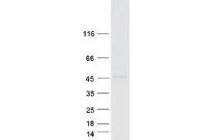 Validation with Western Blot