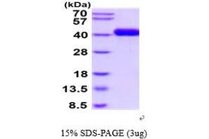 SDS-PAGE (SDS) image for Plasminogen Activator, Urokinase Receptor (PLAUR) (AA 23-305) protein (His tag) (ABIN5854659)