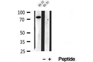 Western blot analysis of extracts of HEK-293 cells, using IFT81 antibody. (IFT81 anticorps)