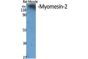 Western Blot (WB) analysis of specific cells using Myomesin-2 Polyclonal Antibody. (MYOM2 anticorps  (Internal Region))