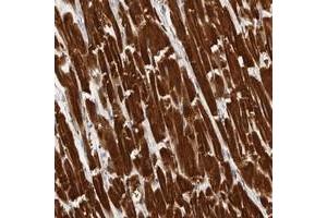 Immunohistochemical staining of human heart muscle with UBE3D polyclonal antibody  shows strong cytoplasmic positivity in myocytes at 1:20-1:50 dilution. (UBE3D anticorps)