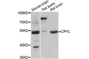 Western blot analysis of extracts of various cell lines, using CPVL antibody (ABIN6292365) at 1:3000 dilution. (CPVL anticorps)