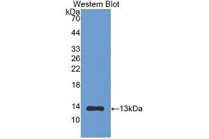 Western Blotting (WB) image for anti-beta-2-Microglobulin (B2M) (AA 21-119) antibody (ABIN1077856) (beta-2 Microglobulin anticorps  (AA 21-119))