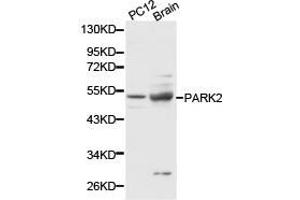 Western Blotting (WB) image for anti-Parkinson Protein 2, E3 Ubiquitin Protein Ligase (Parkin) (PARK2) antibody (ABIN1874032) (Parkin anticorps)