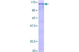 Image no. 1 for Adaptor-Related Protein Complex 2, beta 1 Subunit (AP2B1) (AA 1-951) protein (GST tag) (ABIN1345243)