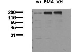 Western Blotting (WB) image for anti-Epidermal Growth Factor Receptor (EGFR) (pThr678) antibody (ABIN126757) (EGFR anticorps  (pThr678))