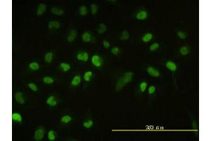 Immunofluorescence of monoclonal antibody to UBE2H on HeLa cell. (UBE2H anticorps  (AA 1-183))