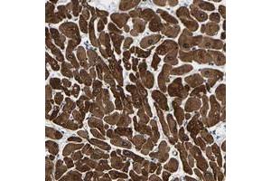 Immunohistochemical staining of human heart muscle with METTL16 polyclonal antibody  shows strong cytoplasmic positivity in myocytes at 1:200-1:500 dilution. (METTL16 anticorps)