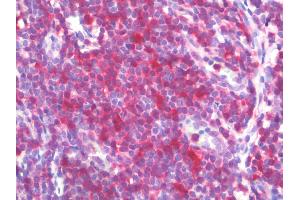 Anti-STAT1 antibody IHC staining of human tonsil.