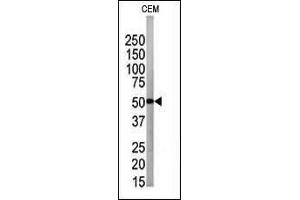 The anti-G4B Pab 1809a is used in Western blot to detect G4B in CEM tissue lysate (ATG4B anticorps  (N-Term))