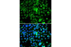 Immunofluorescence analysis of A549 cell using NAP1L3 antibody. (NAP1L3 anticorps)