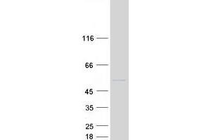 Validation with Western Blot