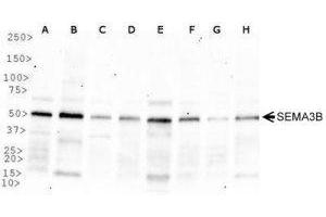 Western Blotting (WB) image for anti-Sema Domain, Immunoglobulin Domain (Ig), Short Basic Domain, Secreted, (Semaphorin) 3B (SEMA3B) (AA 100-200) antibody (ABIN1951824)