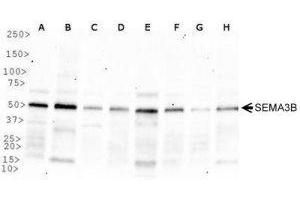 Western Blotting (WB) image for anti-Sema Domain, Immunoglobulin Domain (Ig), Short Basic Domain, Secreted, (Semaphorin) 3B (SEMA3B) (AA 100-200) antibody (ABIN1951824) (SEMA3B anticorps  (AA 100-200))