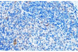 Immunohistochemistry of paraffin-embedded Mouse spleen using ADAR Polyclonal Antibody at dilution of 1:100 (40x lens). (ADAR anticorps)