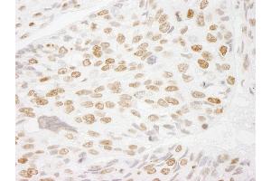 Immunohistochemistry (IHC) image for anti-Histone H3 (H3) (C-Term) antibody (ABIN7448974)