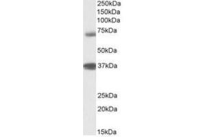 Antibody (1µg/ml) staining of Peripheral Blood Lymphocytes lysate (35µg protein in RIPA buffer). (TRIM29 anticorps  (Internal Region))