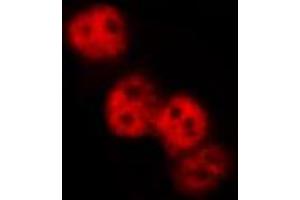 ABIN6267571 staining NIH-3T3 by IF/ICC. (SMAD3 anticorps  (pSer425))