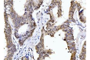 IHC analysis of Cyclophilin E/PPIE using anti-Cyclophilin E/PPIE antibody (ABIN7599242). (PPIE anticorps  (AA 1-301))