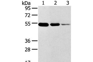 Western Blot analysis of Human thyroid and esophagus cancer, Human normal rectum tissue using TMPRSS11F Polyclonal Antibody at dilution of 1:500 (TMPRSS11F anticorps)