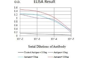 Black line: Control Antigen (100 ng),Purple line: Antigen (10 ng), Blue line: Antigen (50 ng), Red line:Antigen (100 ng)