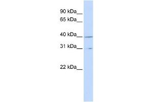 WB Suggested Anti-CCNH Antibody Titration:  0. (Cyclin H anticorps  (Middle Region))