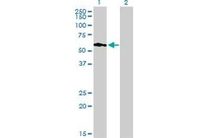 Western Blot analysis of PIP5K3 expression in transfected 293T cell line by PIP5K3 monoclonal antibody (M01), clone 6C7.