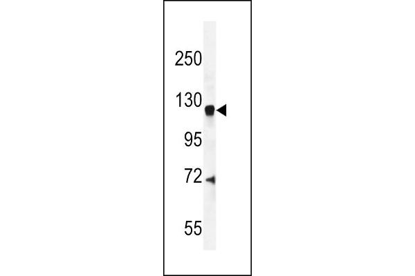 AGAP2 antibody  (C-Term)