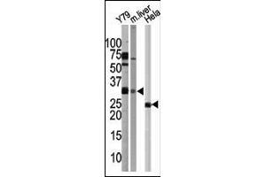 Western blot analysis of G5L Pab in Y79 cell line, mouse liver tissue, and Hela cell line lysates 1812b. (ATG5 anticorps  (C-Term))