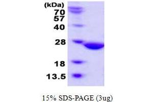 SDS-PAGE (SDS) image for Abhydrolase Domain Containing 14B (ABHD14B) (AA 1-210) protein (His tag) (ABIN667663)