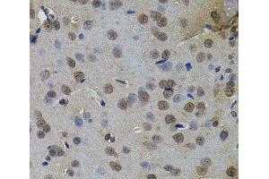 Immunohistochemistry of paraffin-embedded Rat brain using IL33 Polyclonal Antibody (IL-33 anticorps)
