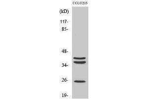 Western Blotting (WB) image for anti-Cathepsin B (CTSB) (Internal Region) antibody (ABIN3174199) (Cathepsin B anticorps  (Internal Region))