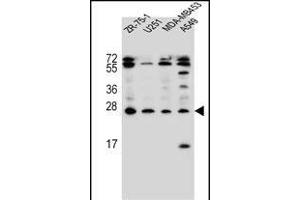 EDN1 Antibody (C-term) (ABIN655912 and ABIN2845311) western blot analysis in ZR-75-1,,MDA-M,A549 cell line lysates (35 μg/lane). (Endothelin 1 anticorps  (C-Term))