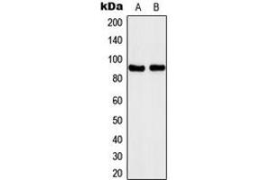 Western blot analysis of Kanadaptin expression in A431 (A), Jurkat (B) whole cell lysates. (NADAP anticorps  (Center))