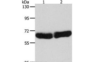 Western Blot analysis of Human fetal liver and brain tissue using CYP1B1 Polyclonal Antibody at dilution of 1:250