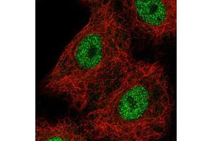 Immunofluorescent staining of A549 cells with HNF1B monoclonal antibody, clone CL0374  (Green) shows spotty nuclear (without nucleoli) staining.