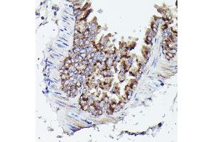 Immunohistochemistry of paraffin-embedded mouse lung using VD Rabbit pAb (ABIN6130775, ABIN6150077, ABIN6150078 and ABIN6214830) at dilution of 1:25 (40x lens).